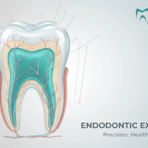 Endodoncia
